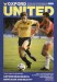 Oxford United v Watford