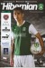 Hibernian v Heart Of Midlothian