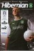 Hibernian v Dundee