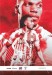Stoke City v Bristol City