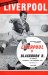 Liverpool v Blackburn Rovers