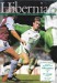 Hibernian v Liege