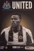 Newcastle United v Burton Albion