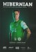 Hibernian v Dundee United
