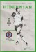 Hibernian v Aston Villa