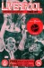 Liverpool v Stoke City